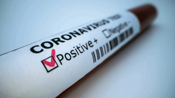 Coronavirus, Covid-19, test, positivo
