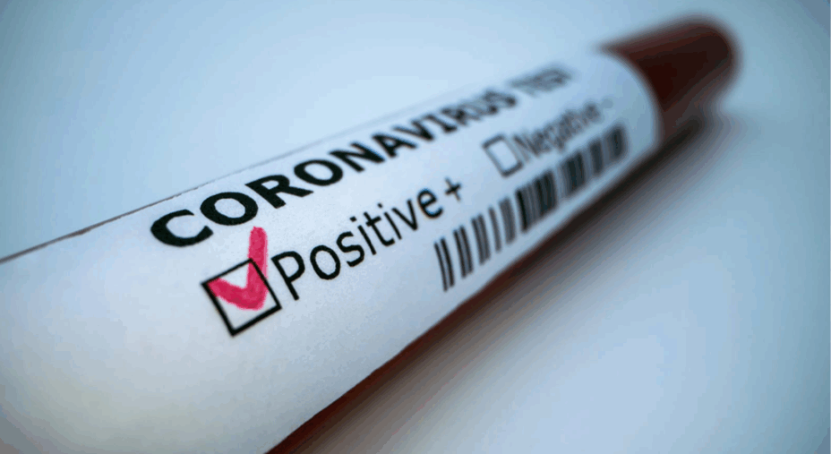 Coronavirus, Covid-19, test, positivo