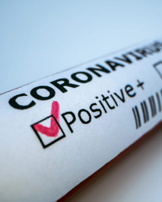 Coronavirus, Covid-19, test, positivo