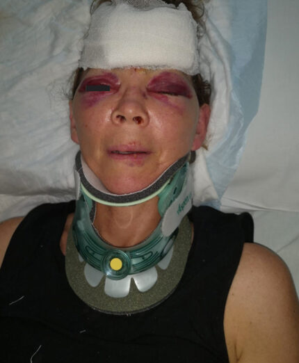 Nonostante i segni evidenti, l'assicurazione non sta ancora liquidando il sinistro in attesa di una sentenza