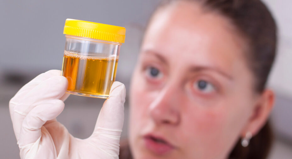 Osservare il colore delle urine dà la misura del grado di idratazione (depositphotos.com)