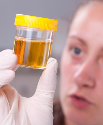Osservare il colore delle urine dà la misura del grado di idratazione (depositphotos.com)